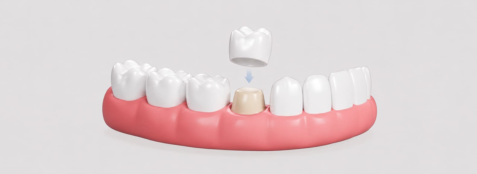crown